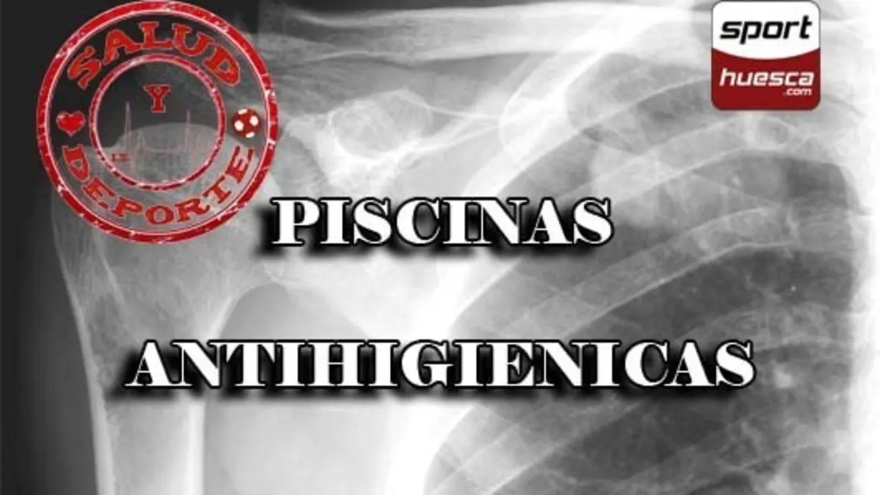 Fotomontaje: C. Pascual