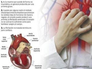 foto articulo corazon muerte subita